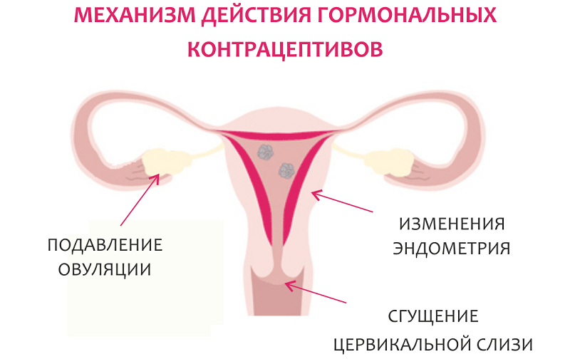 Контрацепция при сахарном диабете: основные способы и препараты