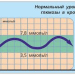 Описание сахарного диабета второго типа: признаки и профилактика