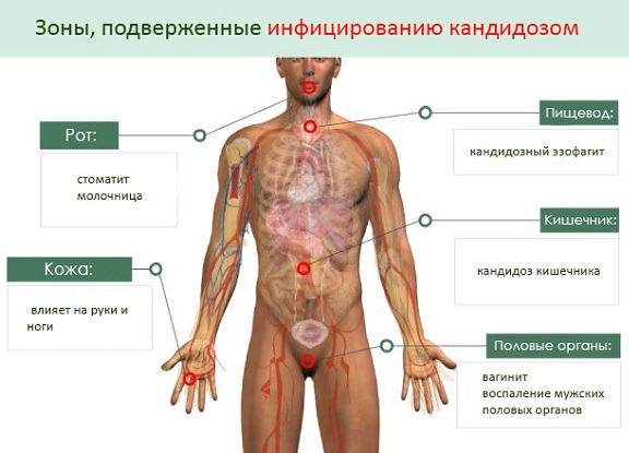 Зуд и жжение в интимной зоне у женщин при сахарном диабете: лечение Зуд и жжение в интимной зоне у женщин при сахарном диабете: лечение