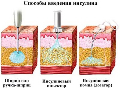 Виды инсулина, их характеристики, свойства, препараты Виды инсулина, их характеристики, свойства, препараты