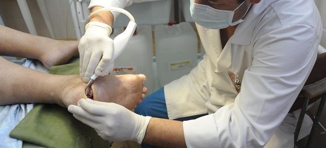 Мази для заживления ран при сахарном диабете: характеристика Мази для заживления ран при сахарном диабете: характеристика