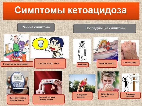 Осложнения при сахарном диабете II типа