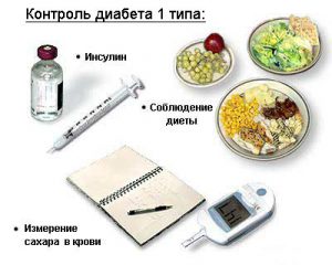 Сахарный диабет 1 типа: причины, симптомы, диагностика, лечение Сахарный диабет 1 типа: причины, симптомы, диагностика, лечение