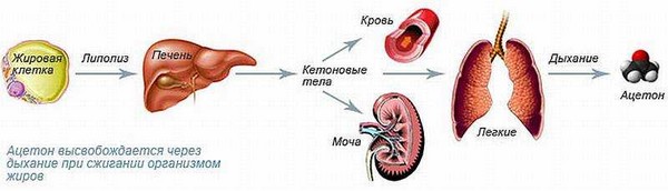 Ацетон в моче при сахарном диабете