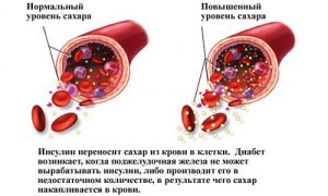 Нормы содержания сахара в крови человека: таблица по возрастам