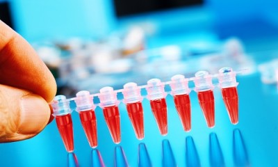 Нарушение толерантности к глюкозе: симптомы и лечение, что это такое ?