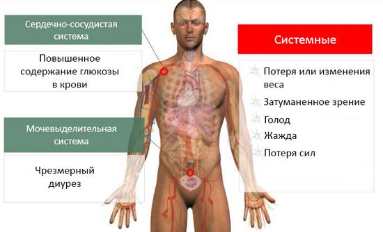 Признаки сахарного диабета у мужчин