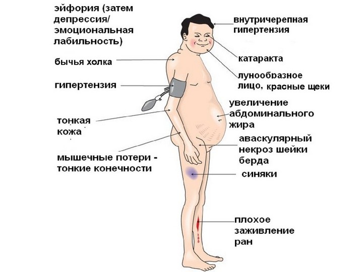 Симптомы низкого сахара в крови Симптомы низкого сахара в крови