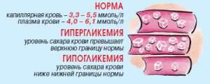 Нормы содержания сахара в крови человека: таблица по возрастам