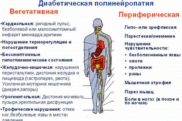 Диагностика и лечение диабетической полинейропатии Диагностика и лечение диабетической полинейропатии