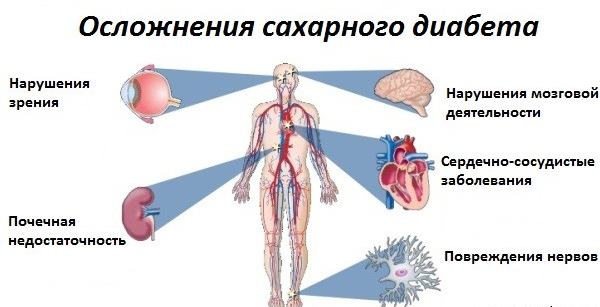 Признаки сахарного диабета у мужчин