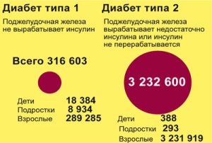 Типы сахарного диабета: в чем отличия Типы сахарного диабета: в чем отличия