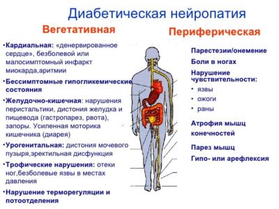 Диабетическая нейропатия: симптомы и лечение, что это такое? Диабетическая нейропатия: симптомы и лечение, что это такое?