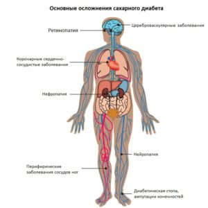 Чем опасен и страшен сахарный диабет: разница между 1 и 2 типом Чем опасен и страшен сахарный диабет: разница между 1 и 2 типом