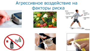 Факторы и группы риска развития сахарного диабета 2 типа