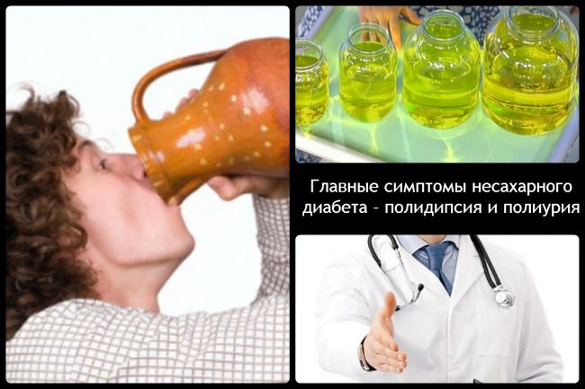 Симптомы и лечение несахарного диабета у детей Симптомы и лечение несахарного диабета у детей