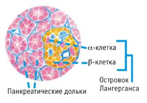 Сахарный диабет 1 типа: что это такое, симптомы, как победить