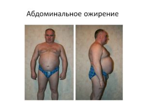 Что такое метаболизм и метаболический синдром в организме человека